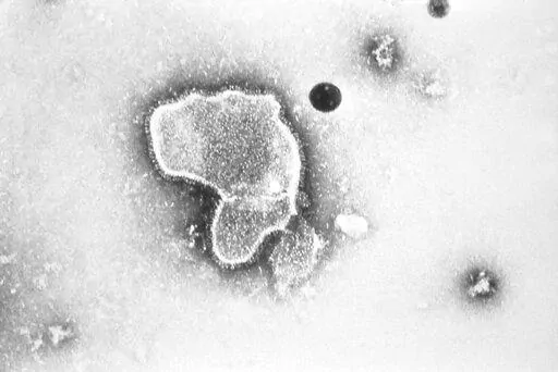 This 1981 photo provided by the Centers for Disease Control and Prevention (CDC) shows an electron micrograph of Respiratory Syncytial Virus, also known as RSV. Children's hospitals in parts of the country are seeing a distressing surge in RSV, a common respiratory illness that can cause severe breathing problems for babies. Cases fell dramatically two years ago as the pandemic shut down schools, day cares and businesses. Then, with restrictions easing, the summer of 2021 brought an alarming inc