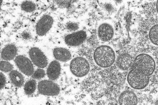 This 2003 electron microscope image made available by the Centers for Disease Control and Prevention shows mature, oval-shaped monkeypox virions, left, and spherical immature virions, right, obtained from a sample of human skin associated with the 2003 prairie dog outbreak. The spread of monkeypox in the U.S. in 2022 could represent the dawn of a new sexually transmitted disease, or it could yet be contained. Or it might be too early to tell. (Cynthia S. Goldsmith, Russell Regner/CDC via AP, Fil
