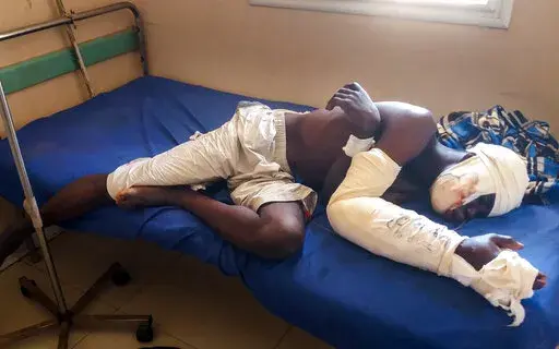 Saga Saganla, 30, from Diawely, lies on his bed at Somine Dolo hospital in Mopti, Mali, Friday June 24, 2022. Saganla survived an attack by nearly 100 jihadis on motorbikes who had gathered in his village in central Mali Sunday June 19. At least 132 people were killed in several villages in the Bankass area of central Mali during the attack on Saturday and Sunday, according to the government which blames the Group to Support Islam and Muslims jihadi rebels linked to al-Qaida.(AP Photo/ Hamidou S