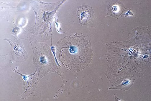 This microscope photo provided by the Mayo Clinic in August 2022 shows senescent myoblast cells. Senescent cells resist apoptosis, or programmed cell death, and characteristically get big and flat, with enlarged nuclei. They release a blend of molecules, some of which can trigger inflammation and harm other cells — and paradoxically also stimulate the growth of malignant cells and fuel cancer, says Mayo Clinic researcher Nathan LeBrasseur. (Dr. Xu Zhang/Mayo Clinic via AP)